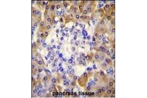 PRDX4 Antibody (Center) (ABIN656035 and ABIN2845408) immunohistochemistry analysis in formalin fixed and paraffin embedded human pancreas tissue followed by peroxidase conjugation of the secondary antibody and DAB staining. (Peroxiredoxin 4 antibody  (AA 82-110))