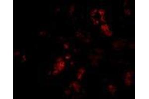 Immunofluorescence of BANF1 in human kidney tissue with AP30118PU-N BANF1 antibody at 20 μg/ml. (BANF1 antibody  (C-Term))