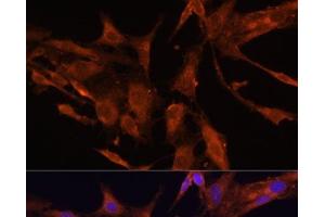 Immunofluorescence analysis of C6 cells using RECK Polyclonal Antibody at dilution of 1:100 (40x lens). (RECK antibody)
