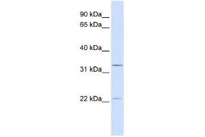 BRI3BP antibody used at 1 ug/ml to detect target protein.