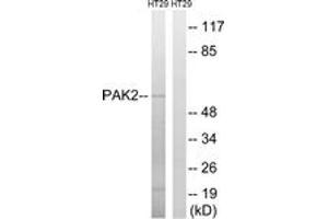 Western blot analysis of extracts from HT-29 cells, using PAK2 (Ab-197) Antibody. (PAK2 antibody  (AA 163-212))