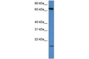 Image no. 1 for anti-Solute Carrier Family 5 (Sodium/glucose Cotransporter), Member 2 (SLC5A2) (AA 250-299) antibody (ABIN6747267) (SLC5A2 antibody  (AA 250-299))