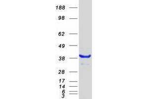 Western Blotting (WB) image for Nonhomologous End-Joining Factor 1 (NHEJ1) protein (Myc-DYKDDDDK Tag) (ABIN2727259)