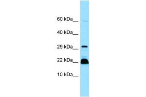 WB Suggested Anti-MYLPF Antibody Titration: 1.