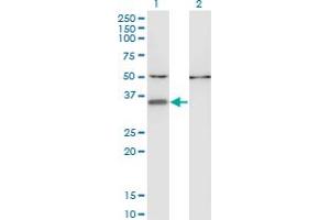 Western Blot analysis of CENPV expression in transfected 293T cell line by CENPV monoclonal antibody (M05), clone 1D9.