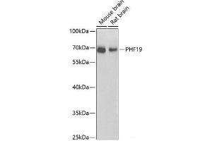 Western blot analysis of extracts of various cell lines using PHF19 Polyclonal Antibody at dilution of 1:1000. (PHF19 antibody)