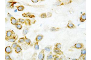 Anti-Thrombospondin 2 antibody, IHC(P) IHC(P): Human Placenta Tissue (Thrombospondin 2 antibody  (Middle Region))