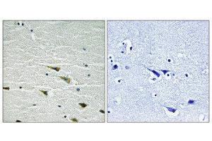 Immunohistochemistry (IHC) image for anti-Neurotrophic Tyrosine Kinase, Receptor, Type 1 (NTRK1) (pTyr757) antibody (ABIN1847658) (TRKA antibody  (pTyr757))
