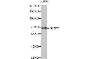 Western blot analysis of extracts of Jurkat cells, using BIRC2 antibody (ABIN5970373) at 1/1000 dilution. (BIRC2 antibody)