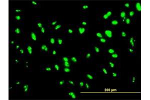 Immunofluorescence of monoclonal antibody to UBTF on HepG2 cell. (UBTF antibody  (AA 551-650))