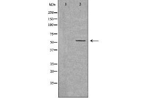 Western blot analysis of extracts from K562 cells, using ZSCAN22 antibody. (ZSCAN22 antibody  (Internal Region))