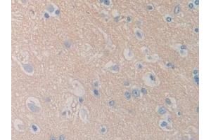 Detection of DDX58 in Human Cerebrum Tissue using Polyclonal Antibody to Probable ATP-dependent RNA Helicase DDX58 (DDX58) (DDX58 antibody  (AA 550-776))