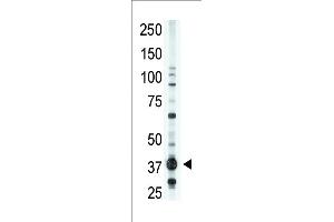 The anti-EDG2 N-term Antibody (ABIN390083 and ABIN2840602) is used in Western blot to detect EDG2 in  lysate.