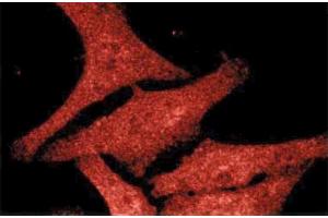Immunofluorescence staining of human fibroblast cells stained with the mouse anti-Casein Kinase Iepsilon antibody.