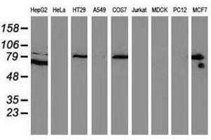 Image no. 2 for anti-Catenin (Cadherin-Associated Protein), beta 1, 88kDa (CTNNB1) antibody (ABIN1496895) (CTNNB1 antibody)