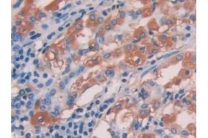 Detection of IL15 in Human Stomach Tissue using Polyclonal Antibody to Interleukin 15 (IL15) (IL-15 antibody  (AA 50-162))