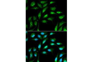 Immunofluorescence analysis of MCF-7 cells using B2M antibody (ABIN5970743). (beta-2 Microglobulin antibody)