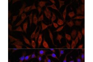 Immunofluorescence analysis of L929 cells using NEDD4L Polyclonal Antibody at dilution of 1:100. (NEDD4-2 antibody)