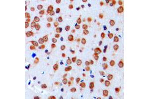 Immunohistochemical analysis of Nav1.