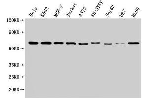 Western Blot Positive WB detected in: Hela whole cell lysate, K562 whole cell lysate, MCF-7 whole cell lysate, Jurkat whole cell lysate, A375 whole cell lysate, SH-SY5Y whole cell lysate, HepG2 whole cell lysate, U87 whole cell lysate, HL60 whole cell lysate All lanes: NOP58 antibody at 1:2000 Secondary Goat polyclonal to rabbit IgG at 1/50000 dilution Predicted band size: 60 kDa Observed band size: 60 kDa (NOP58 antibody  (AA 1-529))