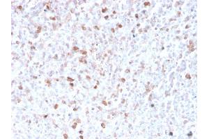 Formalin-fixed, paraffin-embedded human spleen stained with Lambda Light Chain Recombinant Rabbit Monoclonal Antibody (LLC/3778R). (Recombinant IgL antibody)