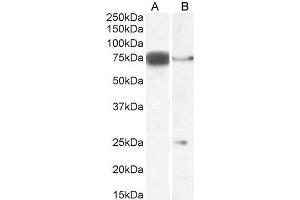 DLL1 antibody  (Internal Region)