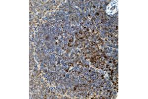 IHC analysis of CD74 using anti-CD74 antibody (ABIN7603166). (CD74 antibody  (N-Term))