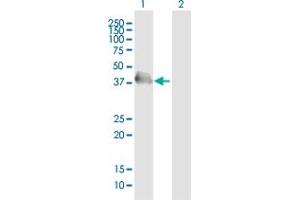 Western Blot analysis of HEL308 expression in transfected 293T cell line ( H00113510-T01 ) by HEL308 MaxPab polyclonal antibody. (HEL308 antibody  (AA 1-272))