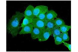 IF analysis of Beta 2 Microglobulin using anti-Beta 2 Microglobulin antibody (ABIN6719452). (beta-2 Microglobulin antibody  (AA 22-119))