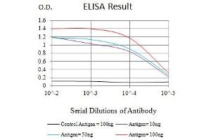 Black line: Control Antigen (100 ng),Purple line: Antigen (10 ng), Blue line: Antigen (50 ng), Red line:Antigen (100 ng) (Topoisomerase II alpha antibody  (AA 1100-1530))