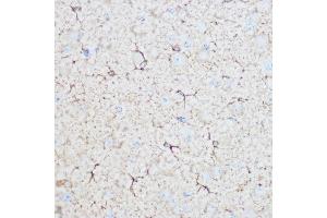 Immunohistochemistry of paraffin-embedded mouse brain using ALDOC Rabbit pAb (ABIN6129897, ABIN6136788, ABIN6136789 and ABIN6215308) at dilution of 1:100 (40x lens). (ALDOC antibody  (AA 1-170))