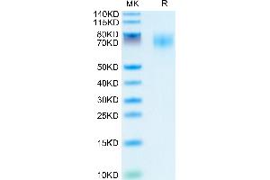 Human TrkB on Tris-Bis PAGE under reduced condition. (TRKB Protein (AA 32-430) (His tag))