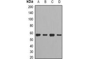 Western blot analysis of CCT2 expression in A549 (A), HT29 (B), mouse spleen (C), mouse heart (D) whole cell lysates. (CCT2 antibody)