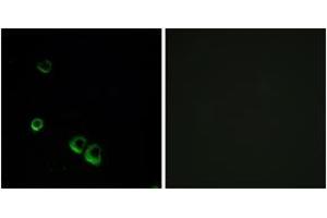 Immunofluorescence analysis of MCF7 cells, using AVPR2 Antibody. (AVPR2 antibody  (AA 72-121))