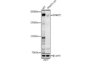 Western blot analysis of extracts from wild type (WT) and DNMT1 knockdown (KD) 293T cells, using DNMT1 antibody (ABIN7266808) at 1:1000 dilution. (DNMT1 antibody)