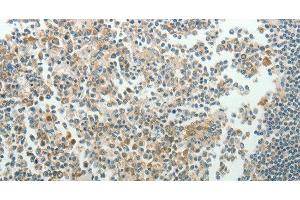 Immunohistochemistry of paraffin-embedded Human tonsil using NDRG3 Polyclonal Antibody at dilution of 1:70 (NDRG3 antibody)