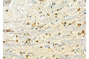 ABIN6263048 and ABIN6276825 at 1/100 staining Rat brain tissue by IHC-P.