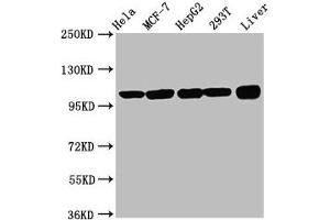Western Blot Positive WB detected in: Hela whole cell lysate, MCF-7 whole cell lysate, HepG2 whole cell lysate, 293T whole cell lysate, Rat liver tissue All lanes: ACTN4 antibody at 3. (alpha Actinin 4 antibody  (AA 160-440))