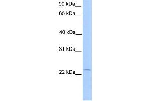 WB Suggested Anti-C5orf39 Antibody Titration: 0. (Chromosome 5 Open Reading Frame 39 (C5orf39) (N-Term) antibody)