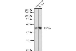 Western blot analysis of extracts of various cell lines, using MA antibody (ABIN7268487) at 1:3000 dilution. (MAT2A antibody)