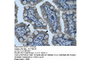 Human Intestine (ZNF461 antibody  (N-Term))