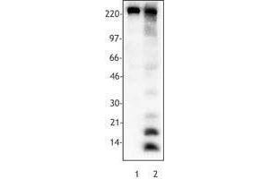 Western Blotting (WB) image for anti-Acetylated Lysine (acetylated) antibody (ABIN2666081) (Acetylated Lysine antibody  (acetylated))