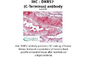 Image no. 1 for anti-Dehydrogenase/reductase (SDR Family) Member 7 (DHRS7) (C-Term) antibody (ABIN1733630) (DHRS7 antibody  (C-Term))