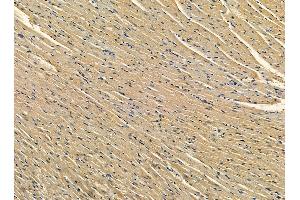ABIN7095376 and ABIN7099433 at 1/100 staining rat heart tissue by IHC-P. (SETD1B antibody)