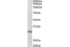 Western Blotting (WB) image for anti-CTD (Carboxy-terminal Domain, RNA Polymerase II, Polypeptide A) Small Phosphatase 1 (CTDSP1) (Internal Region) antibody (ABIN2465010) (CTDSP1 antibody  (Internal Region))