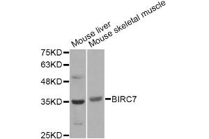 Western blot analysis of extracts of various cell lines, using BIRC7 Antibody. (BIRC7 antibody)