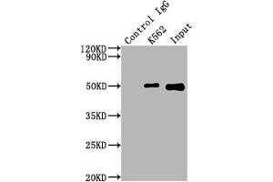 Immunoprecipitating FNTB in K562 whole cell lysate Lane 1: Rabbit control IgG instead of ABIN7127495 in K562 whole cell lysate. (Recombinant FNTB antibody)