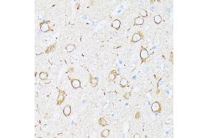 Immunohistochemistry of paraffin-embedded rat brain using βIII-Tubulin/β3-Tubulin  at dilution of 100 (40x lens). (TUBB3 antibody)
