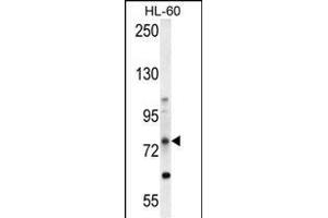 ABCD1 Antibody (Center) (ABIN654412 and ABIN2844150) western blot analysis in HL-60 cell line lysates (35 μg/lane). (ABCD1 antibody  (AA 257-285))