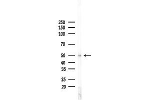 anti-Dual Specificity Phosphatase 10 (DUSP10) (Internal Region) antibody